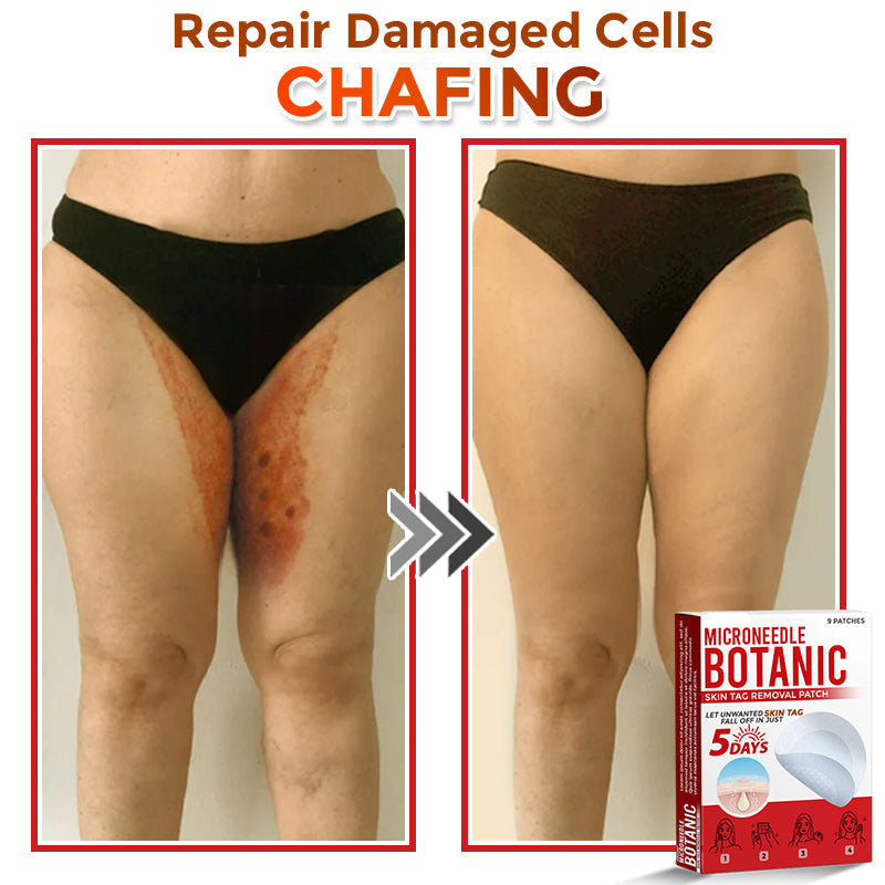LOVILDS® MicroNeedle Botanic Skin Tag Removal Patch 🇺🇸 Made in the USA