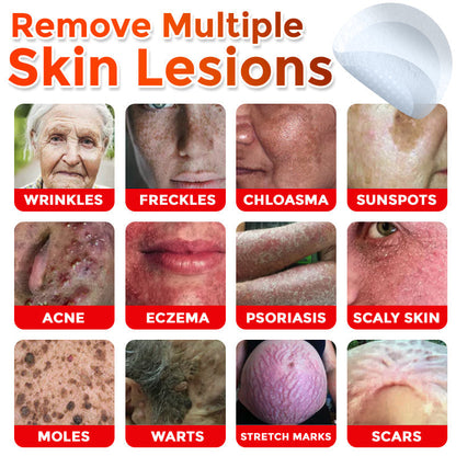 LOVILDS® MicroNeedle Botanic Skin Tag Removal Patch 🇺🇸 Made in the USA